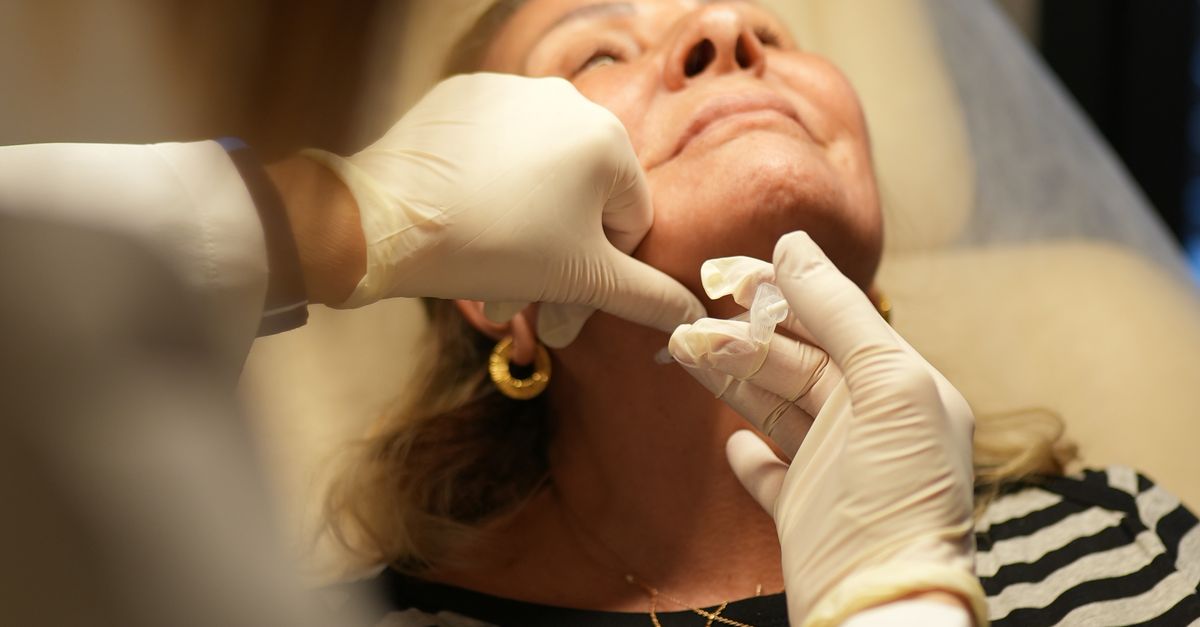 Choosing the Right Chemical Peel for Your Skin Type
