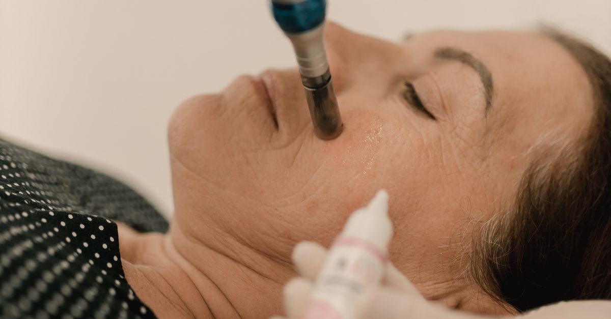 Finding the Right Practitioner for Anti-wrinkle Injections