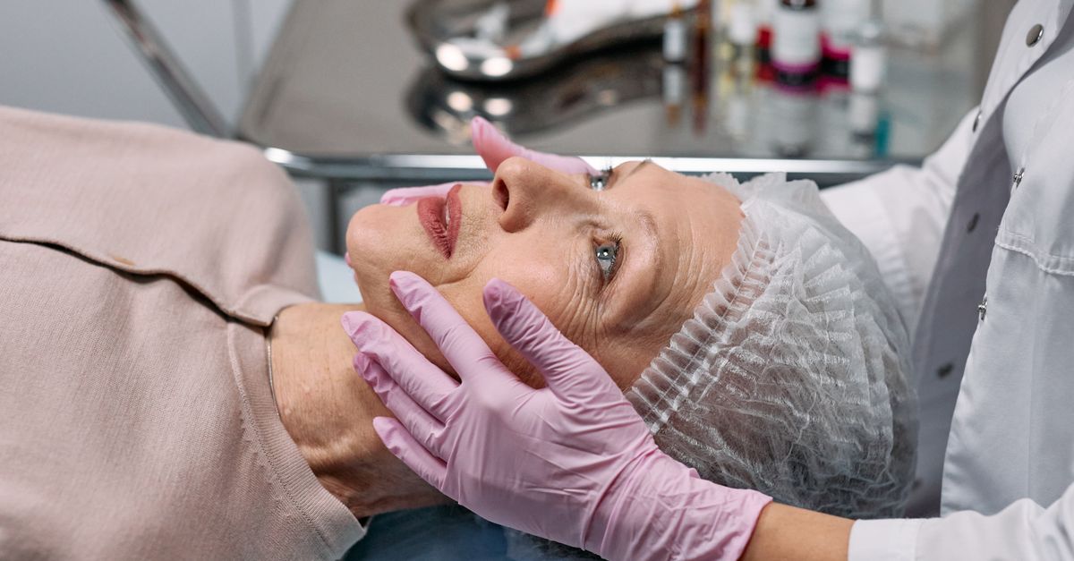 Preparing Your Skin for a Chemical Peel