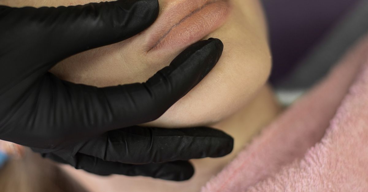 The Lifespan of Common Injectables and What to Expect