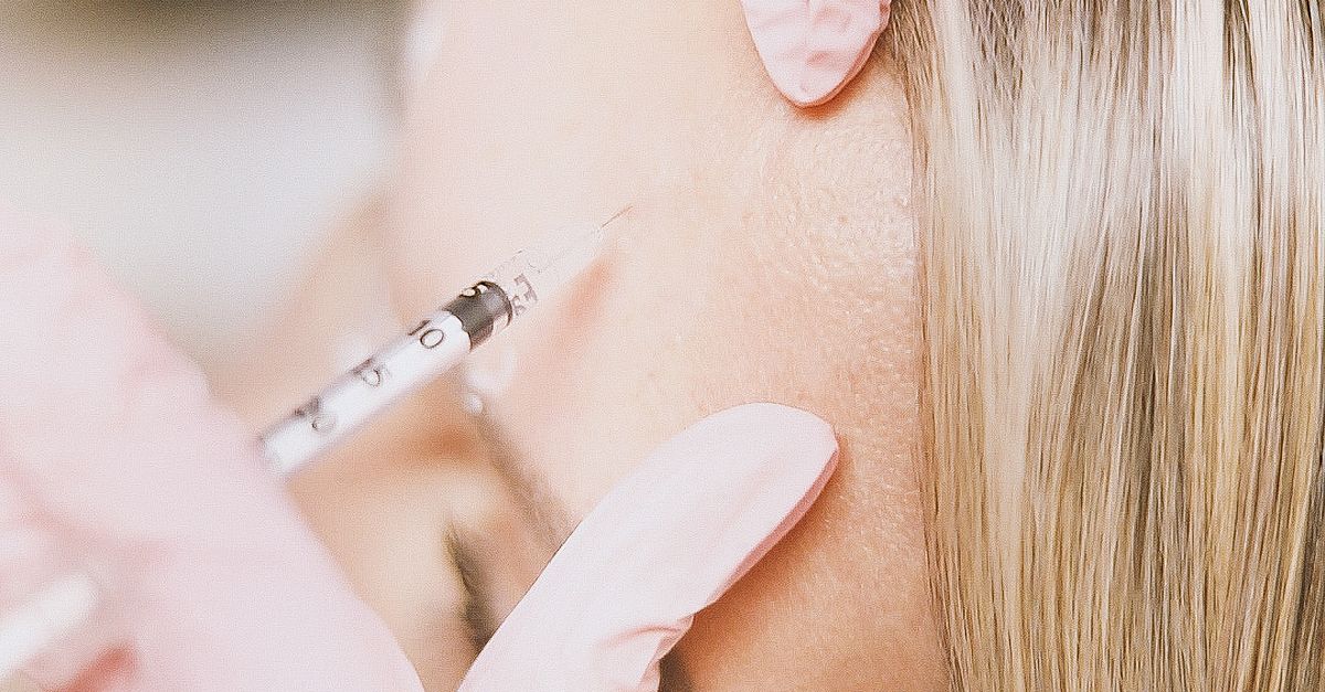 Understanding the Benefits of Chemical Peels for Skin Renewal