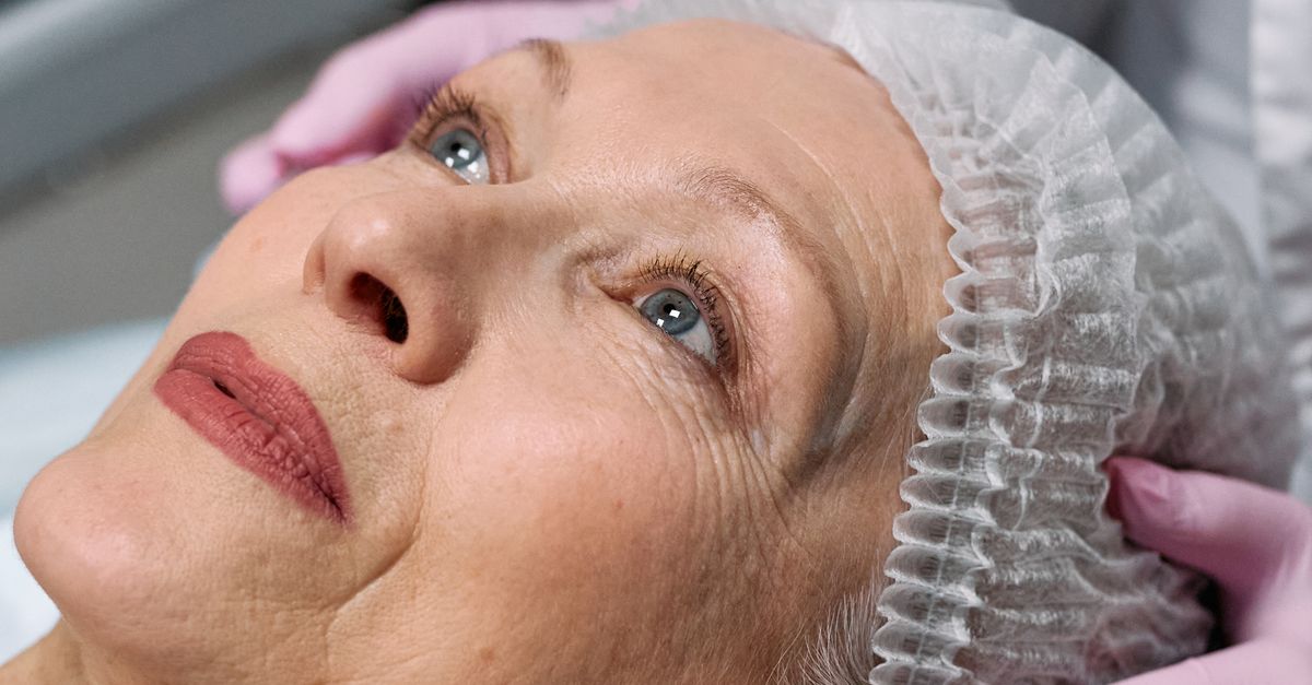 What to Expect During a Laser Hair Removal Treatment